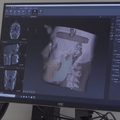 FieldLab 3DMedical on TV