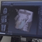 FieldLab 3DMedical on TV